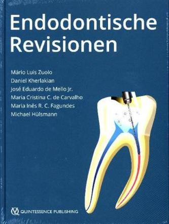 Endodontische Revisionen
