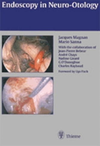 Endoscopy in Neuro-Otology Endoscopy in Neuro-Otology