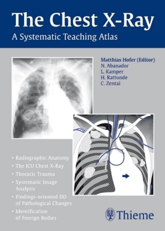 The Chest X-Ray The Chest X-Ray