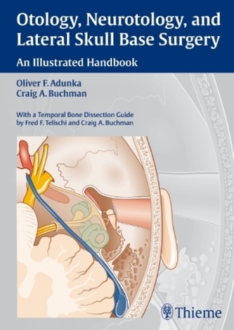 Otology, Neurotology, and Lateral Skull-Base Surgery Otology, Neurotology, and Lateral Skull-Base Surgery