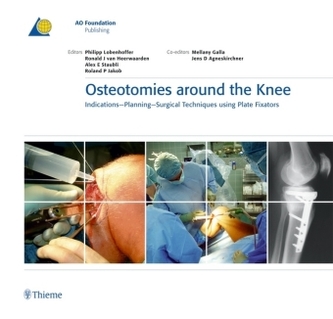 Osteotomies around the Knee Osteotomies around the Knee