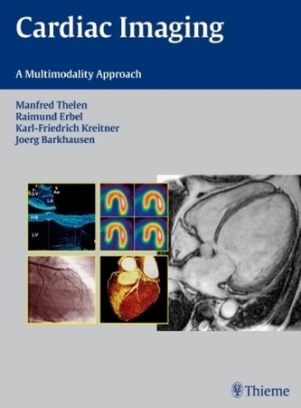 Cardiac Imaging Cardiac Imaging