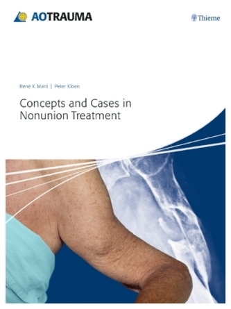Concepts and Cases in Nonunion Treatment Concepts and Cases in Nonunion Treatment
