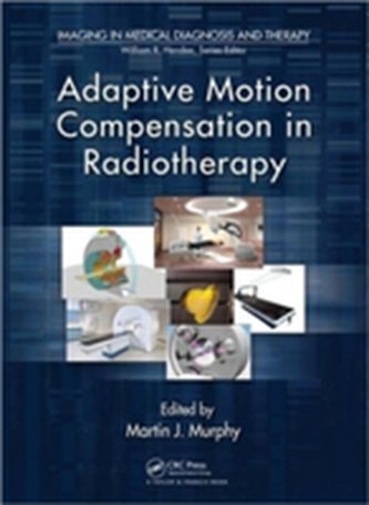 Adaptive Motion Compensation in Radiotherapy