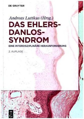 Das Ehlers-Danlos-Syndrom
