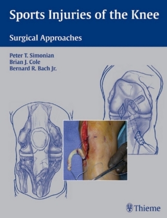 Sport Injuries of the Knee Sport Injuries of the Knee