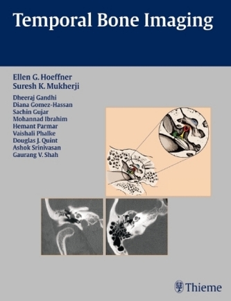 Temporal Bone Imaging Temporal Bone Imaging