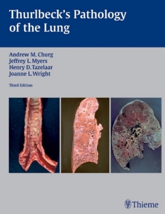 Thurlbeck's Pathology of the Lung Thurlbeck's Pathology of the Lung