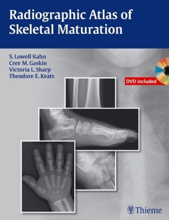 Radiographic Atlas of Skeletal Maturation, m. DVD-ROM Radiographic Atlas of Skeletal Maturation, m. DVD-ROM