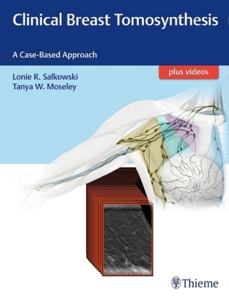 Clinical Breast Tomosynthesis Clinical Breast Tomosynthesis