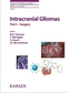 Intracranial Gliomas - Surgery. Pt.1