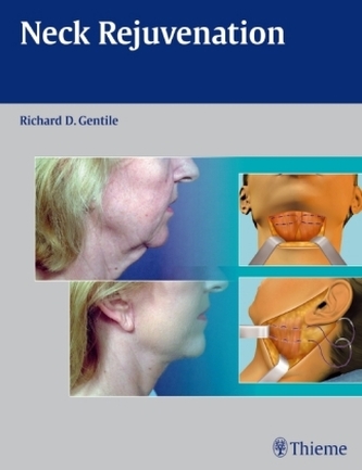 Neck Rejuvenation Neck Rejuvenation