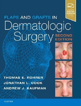 Flaps and Grafts in Dermatologic Surgery Flaps and Grafts in Dermatologic Surgery