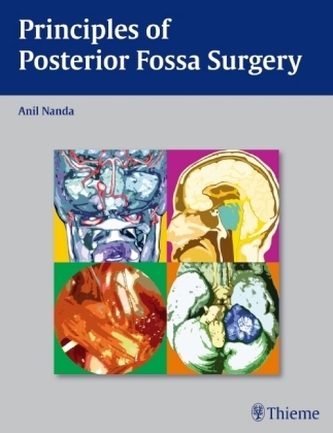 Principles of Posterior Fossa Surgery Principles of Posterior Fossa Surgery