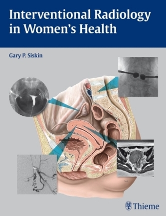 Interventional Radiology in Women's Health Interventional Radiology in Women's Health