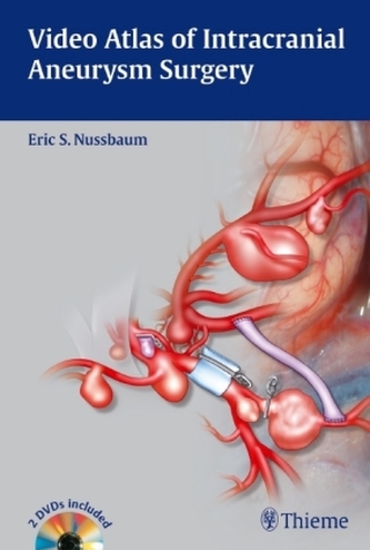 Video Atlas of Intracranial Aneurysm Surgery, w. DVD