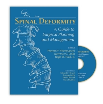 Spinal Deformity, w. DVD