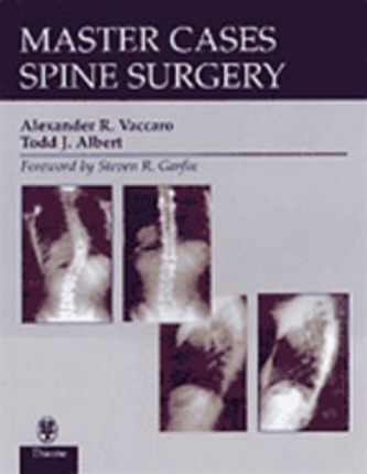 Spine Surgery Spine Surgery