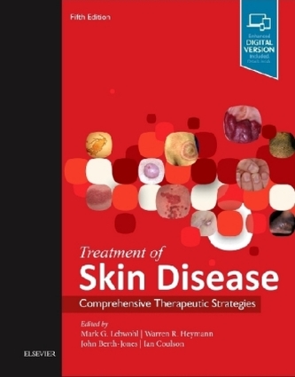 Treatment of Skin Disease Treatment of Skin Disease