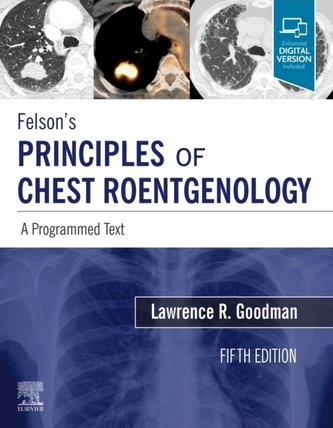 Felson's Principles of Chest Roentgenology, A Programmed Text