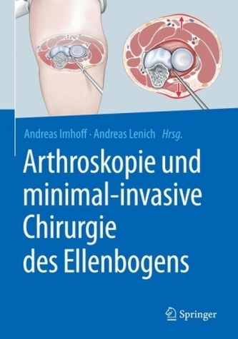 Arthroskopie und minimal-invasive Chirurgie des Ellenbogens Arthroskopie und minimal-invasive Chirurgie des Ellenbogens
