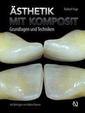 Ästhetik mit Komposit