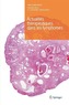 Actualités Thérapeutiques Dans Les Lymphomes