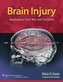 Brain Injury