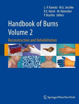 Handbook of Burns. Volume 2