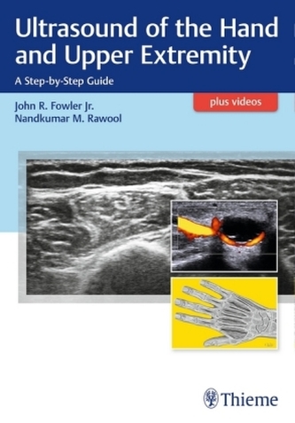 Ultrasound Techniques in the Hand and Upper Limb