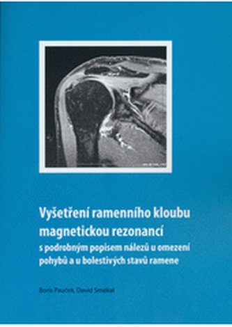Vyšetření ramenního kloubu magnetickou rezonancí s podrobným