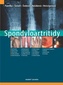 Spondyloartritidy