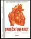 Srdeční infarkt