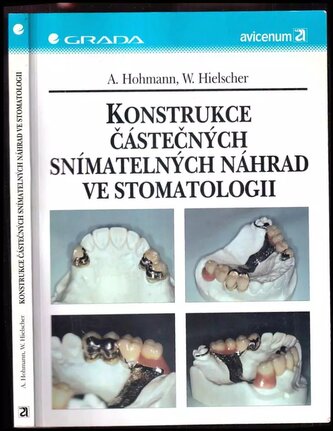 Konstrukce část.sním.náhrad...