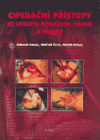 Operační přístupy ke skeletu končetin pánve